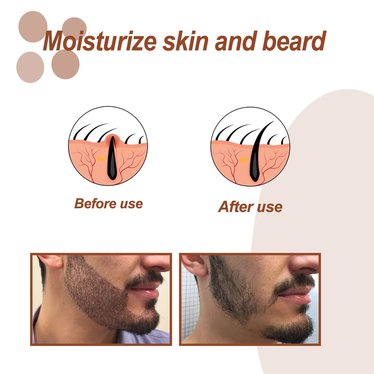 East Moon Beard Growth Oil – Grapeseed & Ginger Root 30ml Beard Growth Oil SWANS