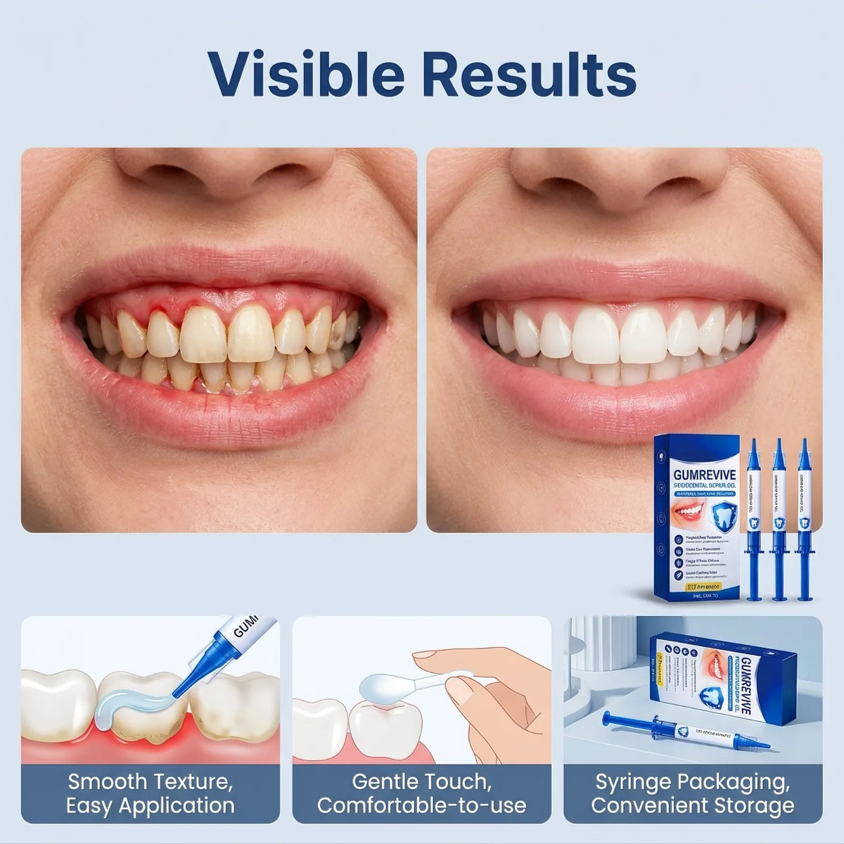 SWANS Gum Repair Gel – Plaque Removal & Teeth Whitening Gum Care Gel SWANS
