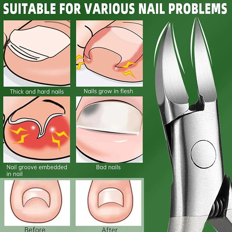 SWANS Oblique Nail Clippers – Stainless Steel Foot & Nail Trimmer Nail Clipper SWANS