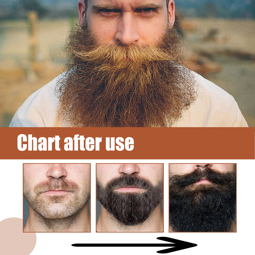 East Moon Beard Growth Oil – Grapeseed & Ginger Root 30ml Beard Growth Oil SWANS