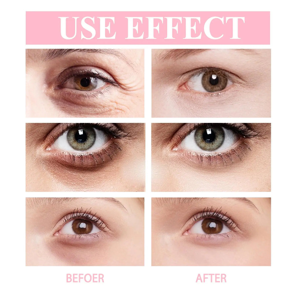 Retinol Eye Cream Stick – Firming, Smoothing & Brightening Eye Cream Stick SWANS