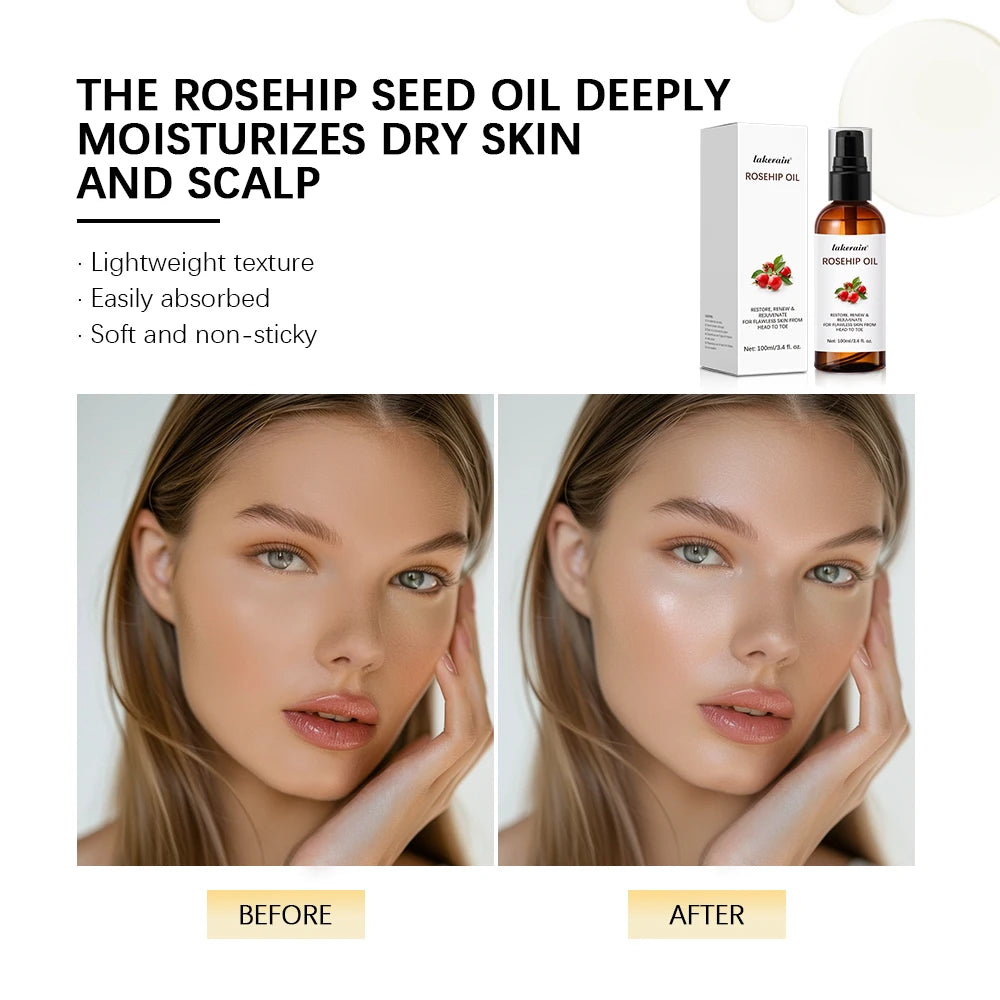 Organic Rosehip Seed Face Oil 30ml – Hydrating Skin Moisturizer Rosehip Face Oil SWANS
