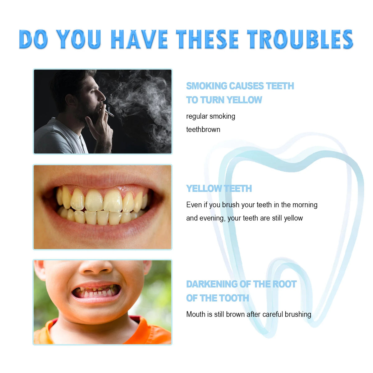 WEST MONTH Teeth Whitening Gel Pen – Natural Stain Removal Teeth Whitening Pen SWANS