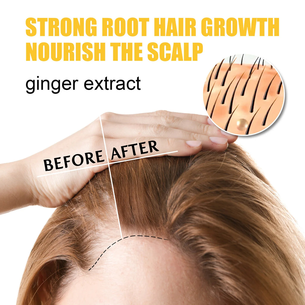 WEST MONTH Ginger Hair Growth Cream – Strengthen & Nourish Hair Growth Cream SWANS