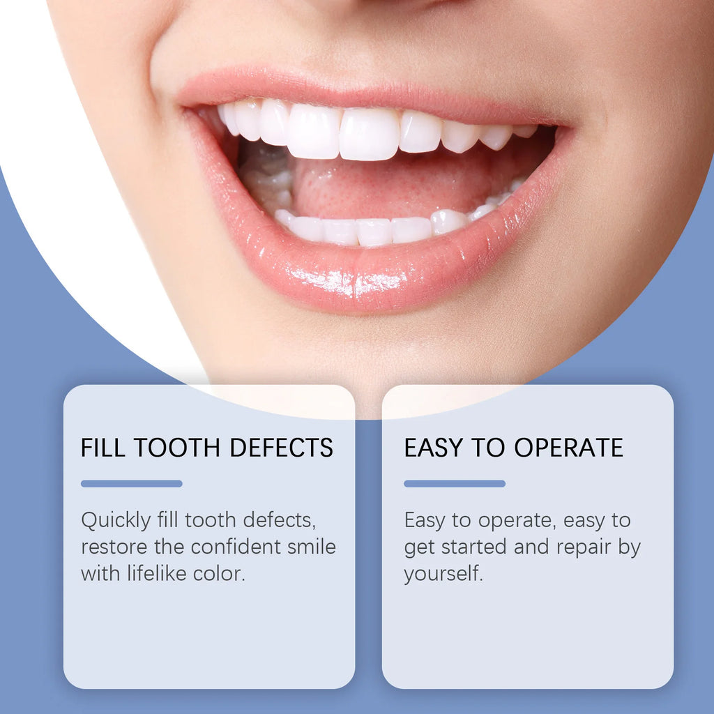 Oralhoe Teeth Whitening & Repair Kit – Blue LED Curing Light Dental Repair Kit SWANS