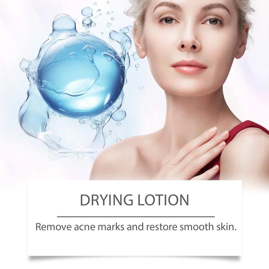 Salicylic Acid Drying Lotion – Oil Control & Pore Clearing Face Drying Lotion SWANS