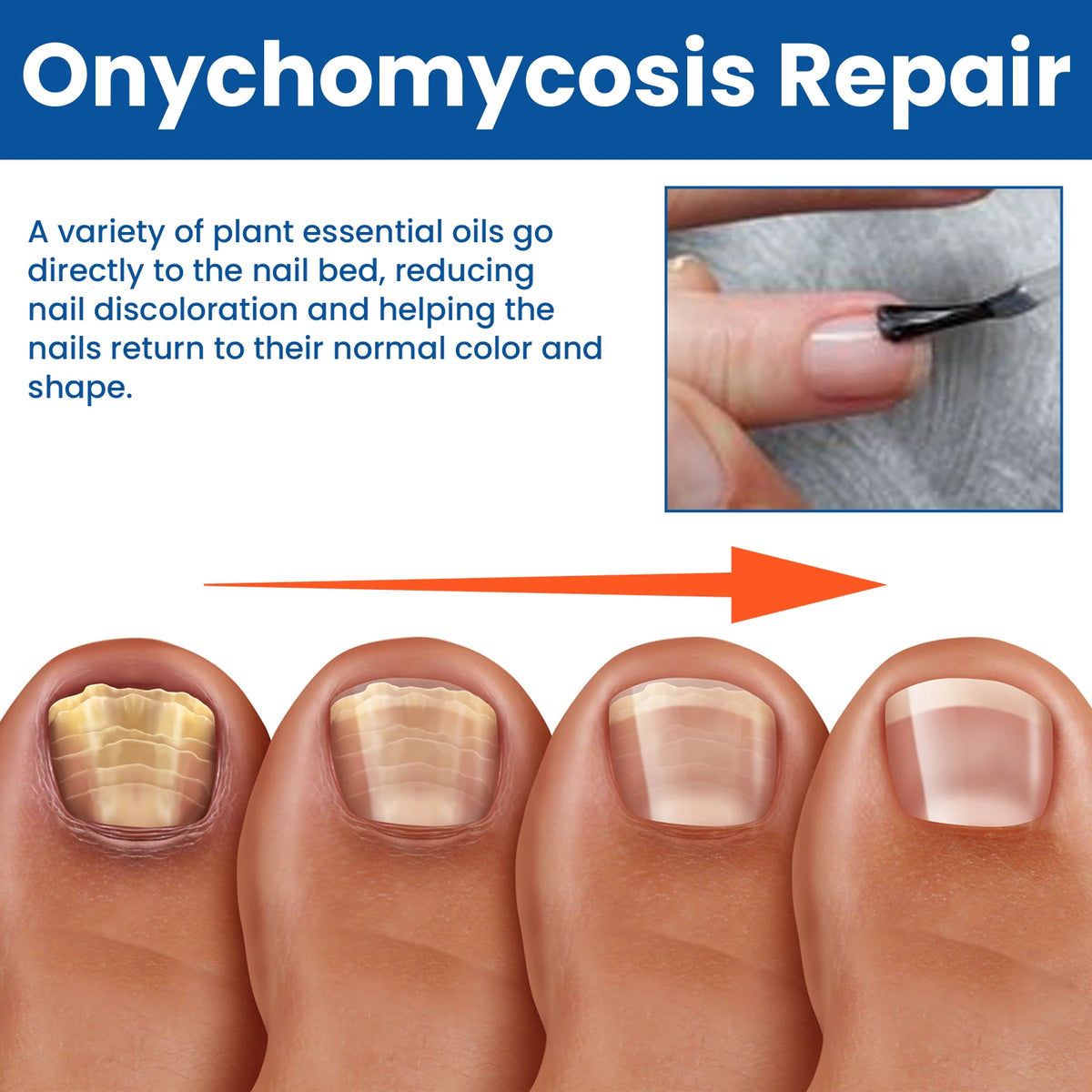 Herbal Nail Repair Liquid – Strengthens & Restores Nails Nail Treatment Liquid SWANS