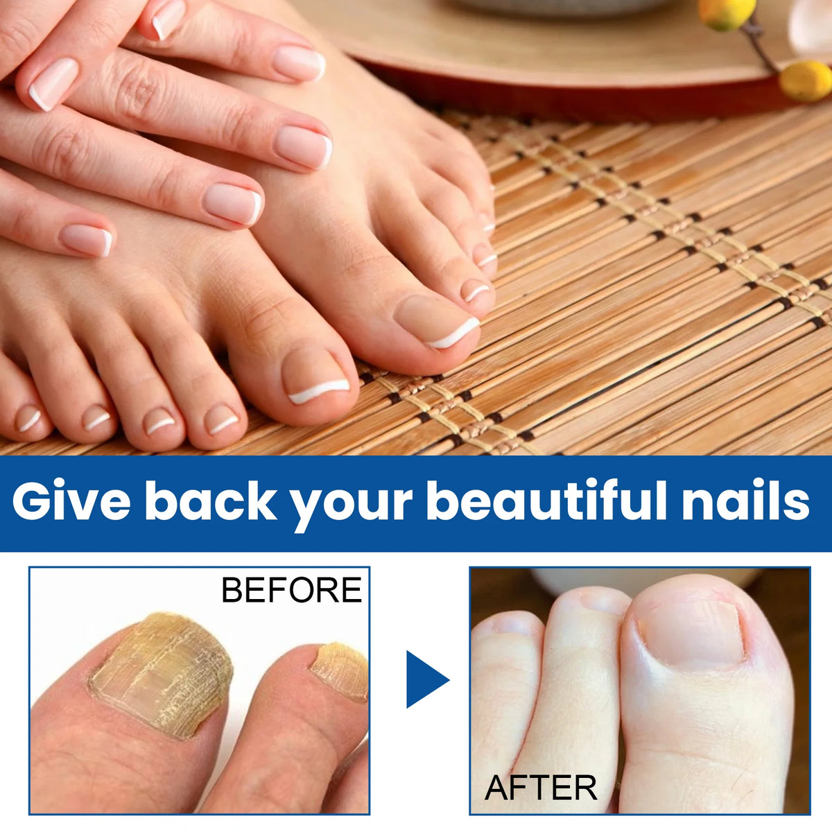Herbal Nail Repair Liquid – Strengthens & Restores Nails Nail Treatment Liquid SWANS