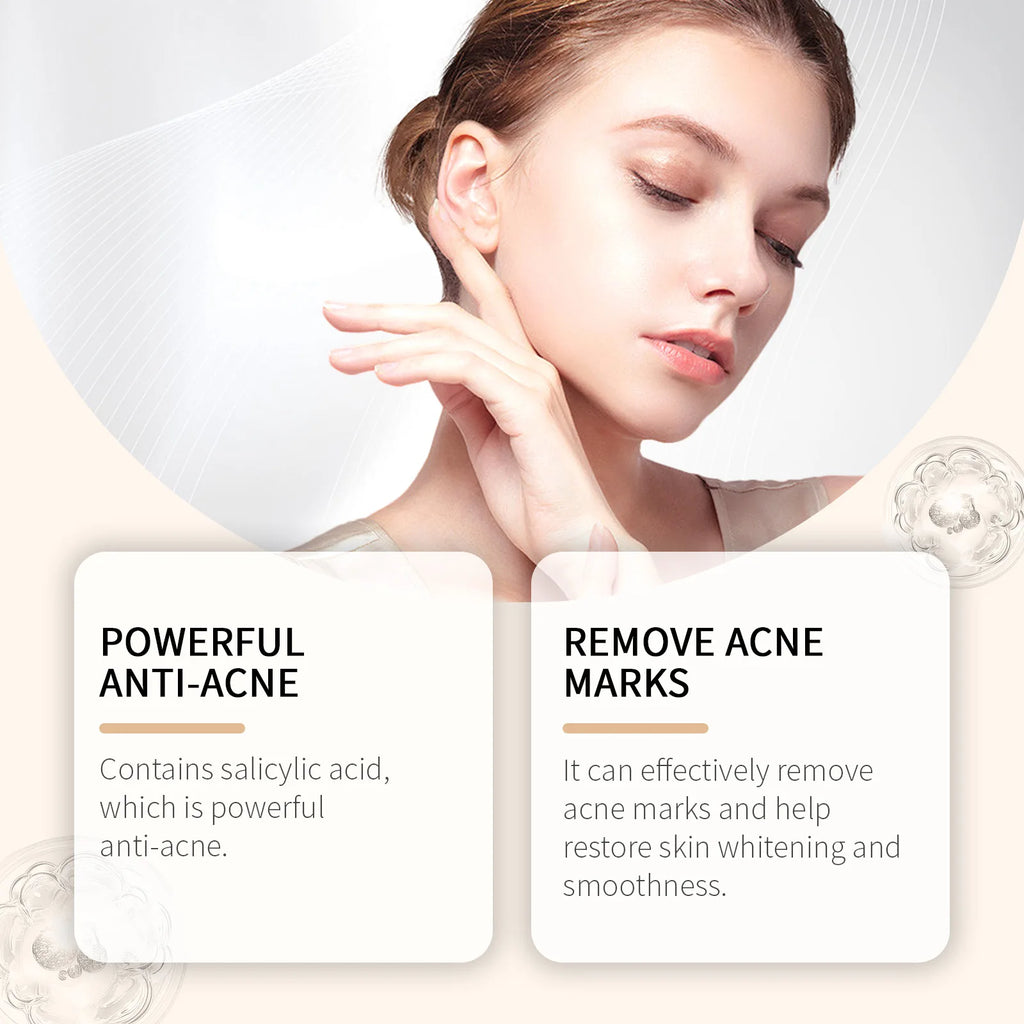 Salicylic Acid Drying Lotion – Oil Control & Pore Clearing Face Drying Lotion SWANS
