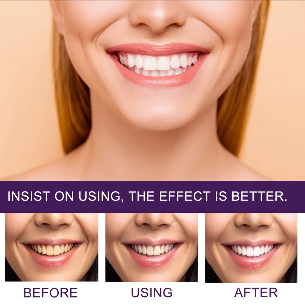 SWANS V34 Purple Toothpaste – Whitening & Stain Removal Whitening Toothpaste SWANS